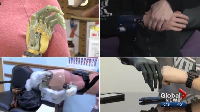 A series of pictures showing a person with a robotic hand.